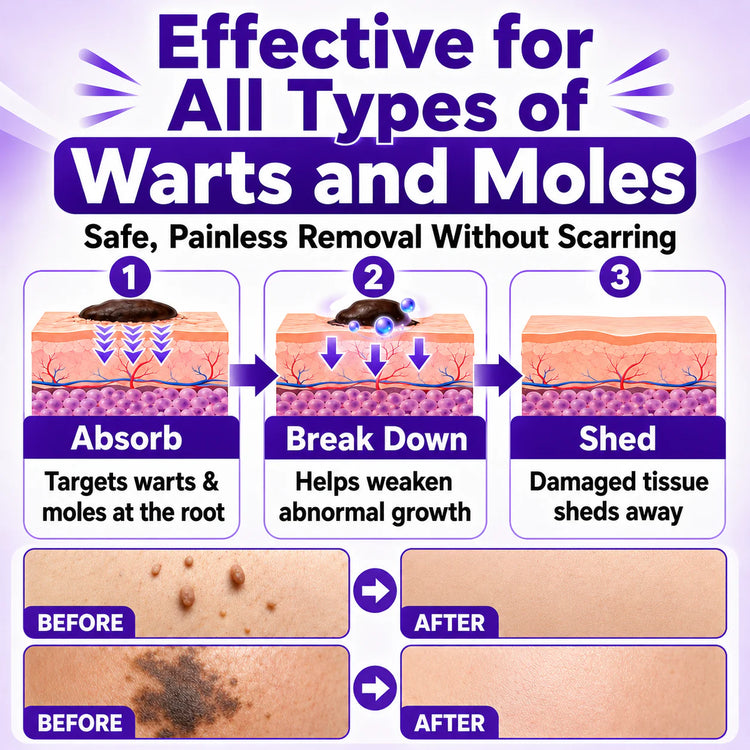 Sylvarre Biotin Cream for Warts and Moles Removal