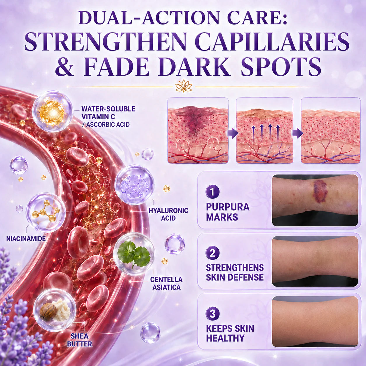 Brightens Dark Spots, Purpura & Evens Out Uneven Skin Tone